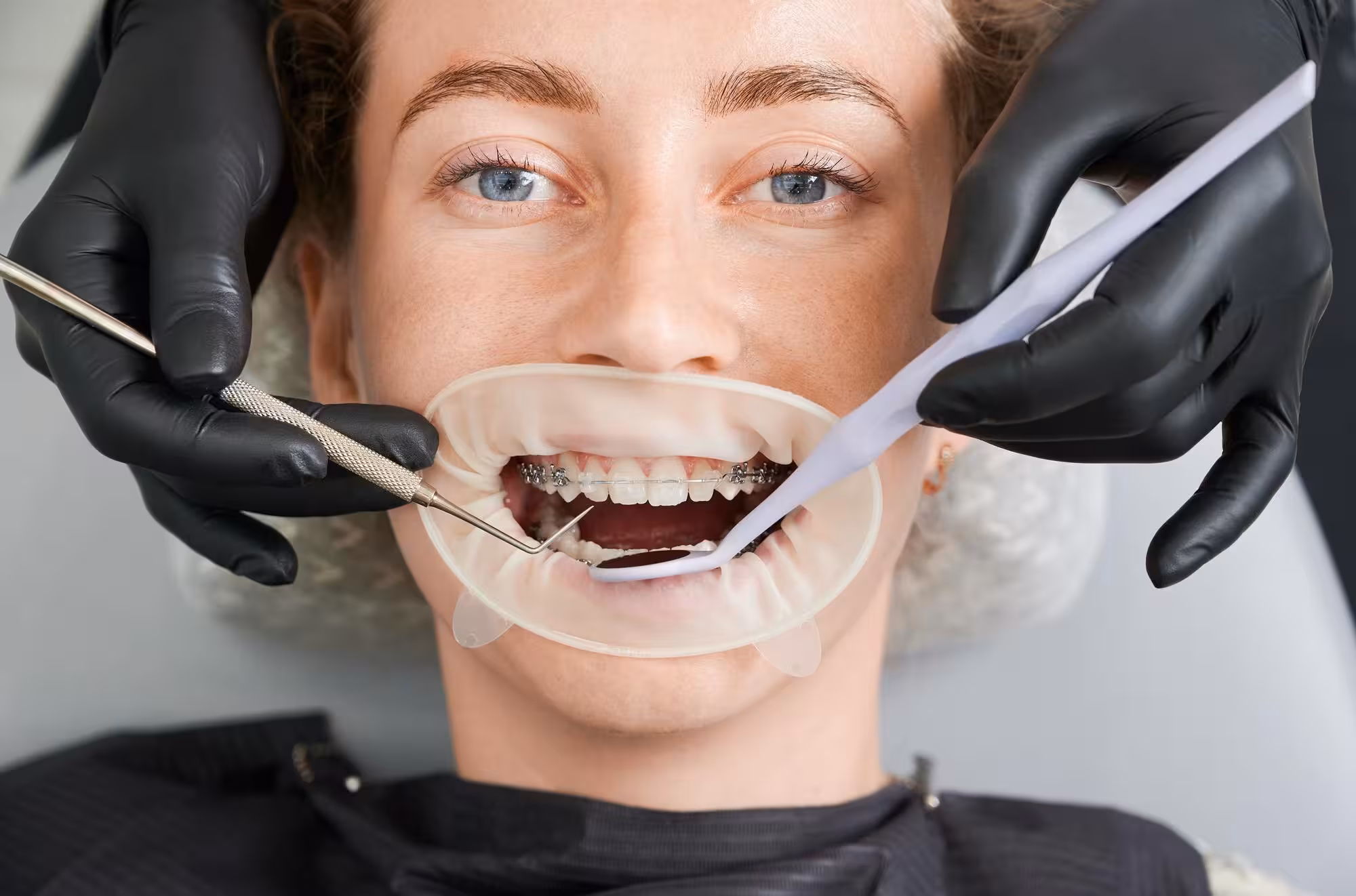 Restorative Dentistry
